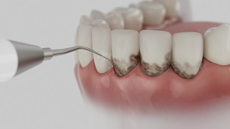 Reliable Emergency Dentist contractor in Bangor, MI by Smile Center Dentistry